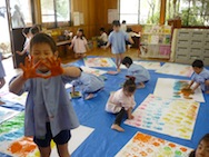 手、こんなんなったわー!